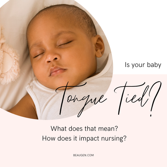 Is Your Baby Tongue Tied?